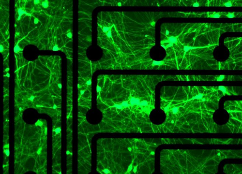 Unangling Celllar Changes in Pediaric Epilepsy